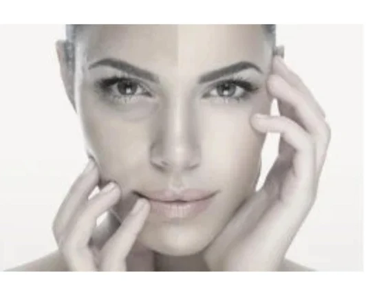 Лифтинг лицо Отбеливание кожи (выравнивание тона)