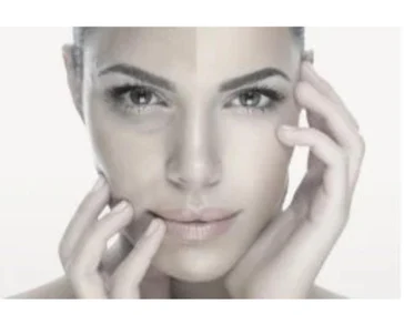 Лифтинг лицо Отбеливание кожи (выравнивание тона)