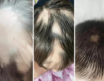 Пробуди силу волос с холодной плазмой